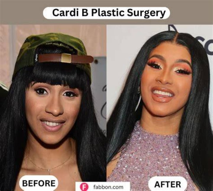 Cardi B Plastic Surgery Before And after Page 10 Bossip