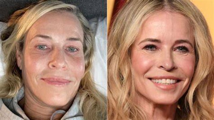 Chelsea Handler No Makeup Mugeek Vidalondon