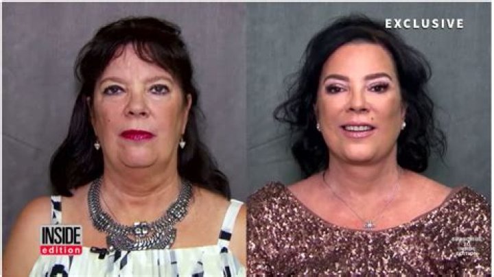 Kris Jenner Sister Facelift